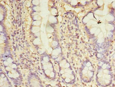 CXCL6 Polyclonal Antibody