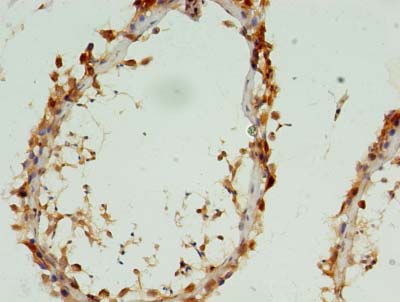 CYTL1 Polyclonal Antibody