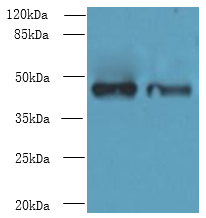 DBF4B Polyclonal Antibody
