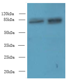 DDHD2 Polyclonal Antibody