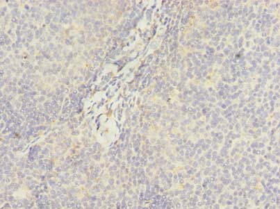 DDX42 Polyclonal Antibody