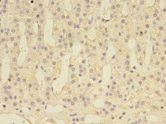 DENND1A Polyclonal Antibody