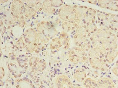 DEXI Polyclonal Antibody