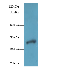 DHRS12 Polyclonal Antibody