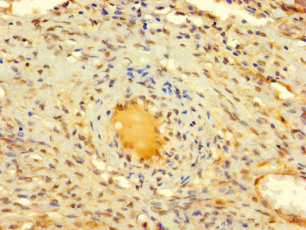 DIS3L2 Polyclonal Antibody