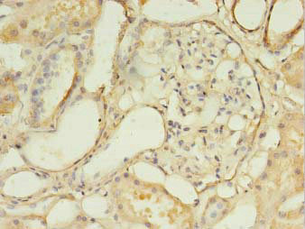 DLEU1 Polyclonal Antibody