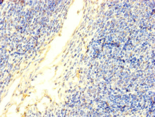 Immunohistochemistry of paraffin-embedded human thymus tissue using DNTT Polyclonal Antibody at dilution of 1:100