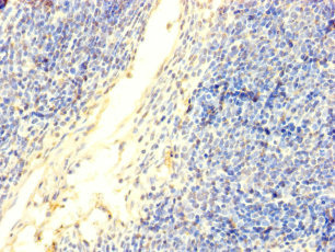 DNTT Polyclonal Antibody