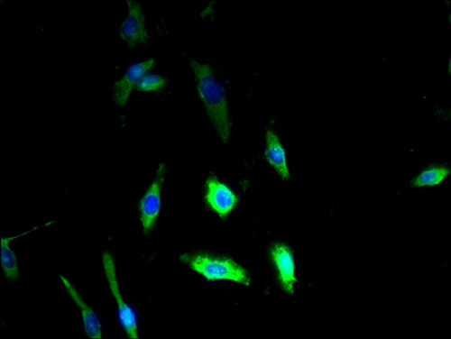 DSE Polyclonal Antibody