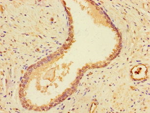 DSTN Polyclonal Antibody