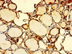 EDEM2 Polyclonal Antibody