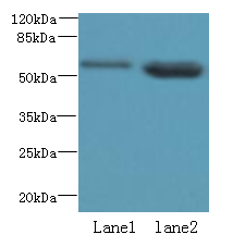 EFCAB14 Polyclonal Antibody