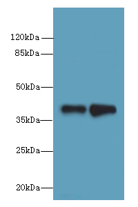 ELAVL4 Polyclonal Antibody