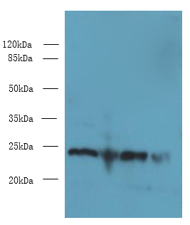 EMC8 Polyclonal Antibody