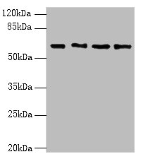 ENC1 Polyclonal Antibody (100 µl)