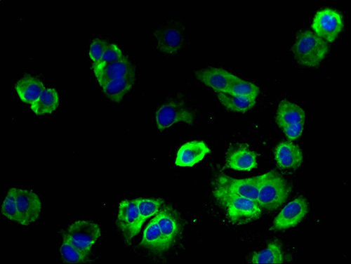 ENTPD3 Polyclonal Antibody