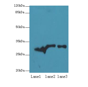 ETHE1 Polyclonal Antibody