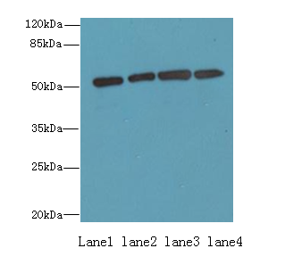 ETNK1 Polyclonal Antibody