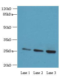 EXOSC5 Polyclonal Antibody (100 µl)