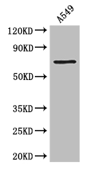 F2 Polyclonal Antibody