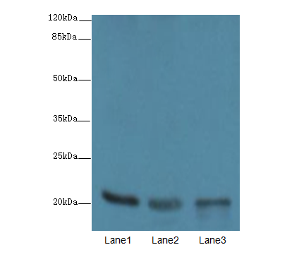 FAIM Polyclonal Antibody