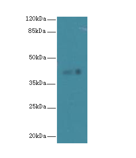 FAM118A Polyclonal Antibody