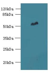 FAM149B1 Polyclonal Antibody
