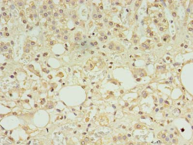 FAM163A Polyclonal Antibody