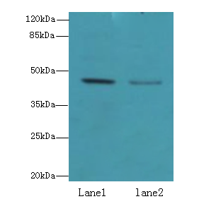 FAM46B Polyclonal Antibody