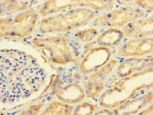 FAM71A Polyclonal Antibody