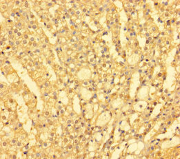 FARP2 Polyclonal Antibody