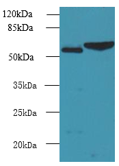 FCRL4 Polyclonal Antibody (100 µl)