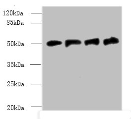 FDXR Polyclonal Antibody (100 µl)