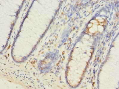 FILIP1L Polyclonal Antibody
