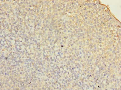 FMNL1 Polyclonal Antibody