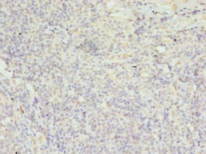 Immunohistochemistry of paraffin-embedded human tonsil at dilution of 1:100