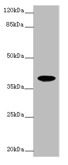 Western blot<br />All lanes: FPR2 Polyclonal Antibody at 1ug/ml+ K562 whole cell lysate<br />Goat polyclonal to rabbit at 1/10000 dilution<br />Predicted band size: 39 kDa<br />Observed band size: 39 kDa<br />