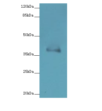 FPR2 Polyclonal Antibody