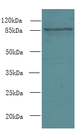 FSCB Polyclonal Antibody