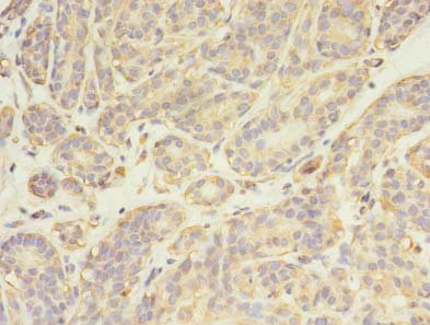 FYN Polyclonal Antibody