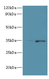 FYTTD1 Polyclonal Antibody