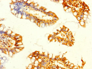 GALK2 Polyclonal Antibody