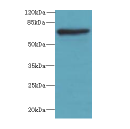 GBP5 Polyclonal Antibody