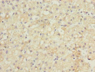 GDF2 Polyclonal Antibody