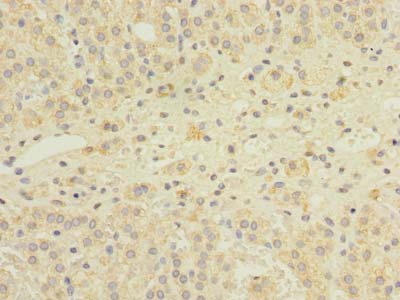 GEMIN8 Polyclonal Antibody