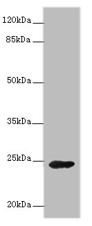 GH2 Polyclonal Antibody (100 µl)