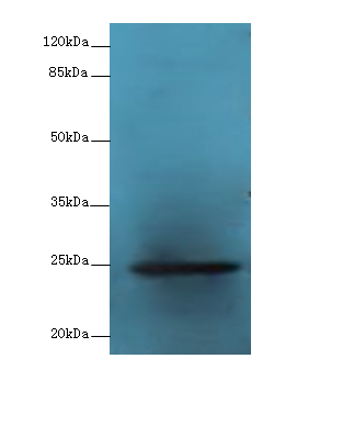 GH2 Polyclonal Antibody