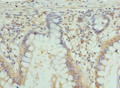 GJA4 Polyclonal Antibody