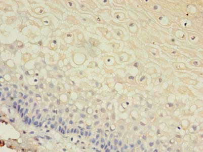 GJB3 Polyclonal Antibody