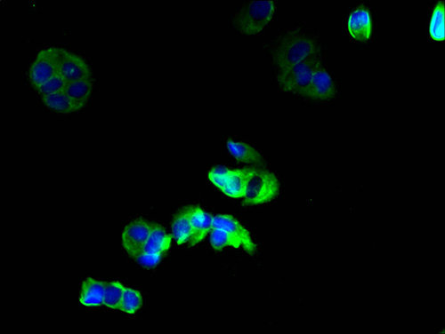 GJB6 Polyclonal Antibody